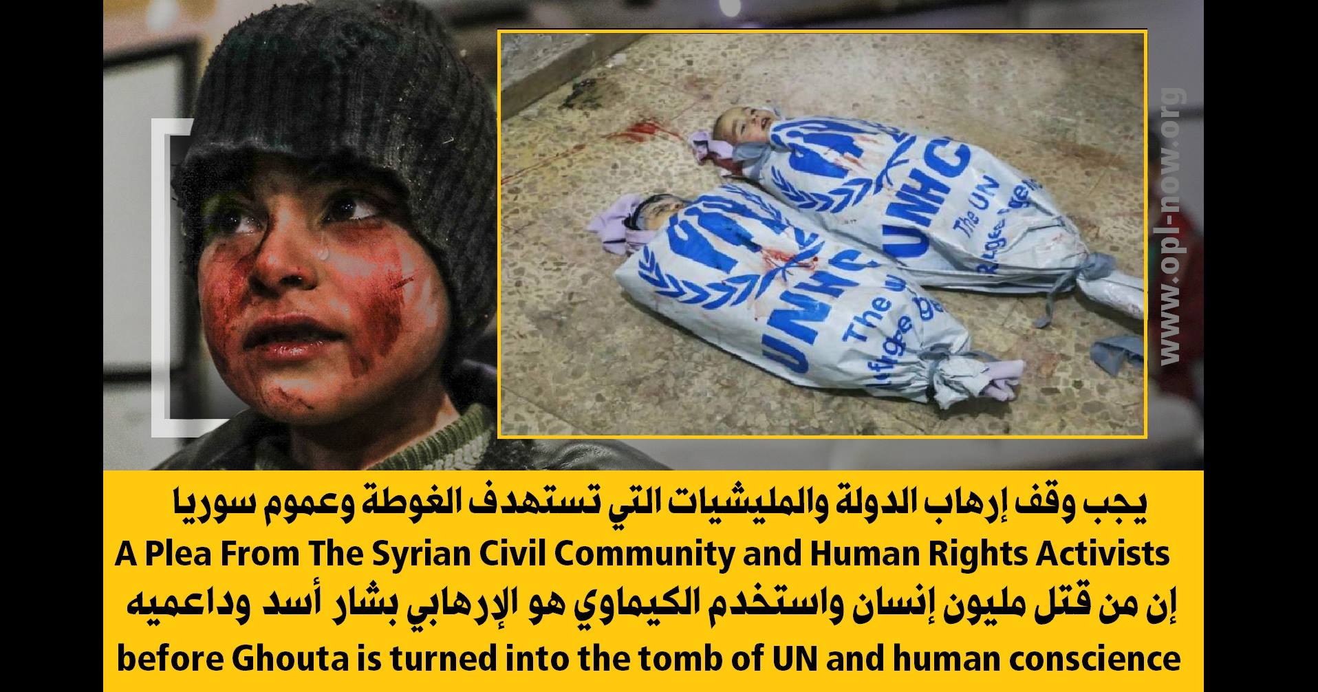 بيان: قبل أن تصبح الغوطة مقبرة الأمم المتحدة والضمير الانساني ….